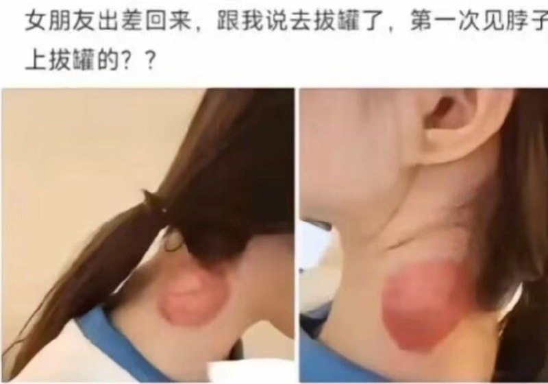 https://media.pincong.rocks/2426c81b74924674b2e734e0e0fd0dd4.jpg?width=800&height=560