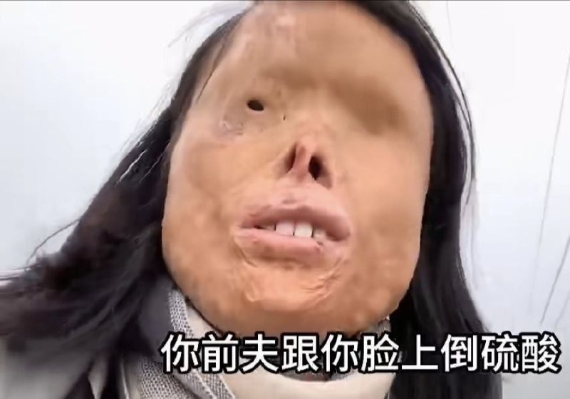 https://media.pincong.rocks/371dbc2e960b4ee485d9329e47608db0.jpg?width=800&height=560