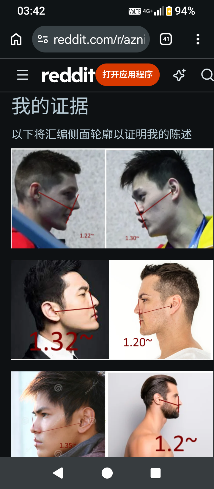 https://media.pincong.rocks/5b97b5dc94b84121a1a1ca4cba006087.png?width=720&height=1640