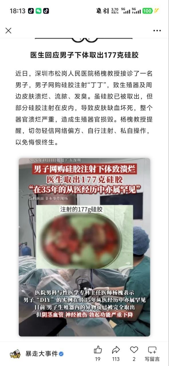 https://media.pincong.rocks/8fbcaefcacf548cbbb5ecd0511a8b127.jpg?width=590&height=1280