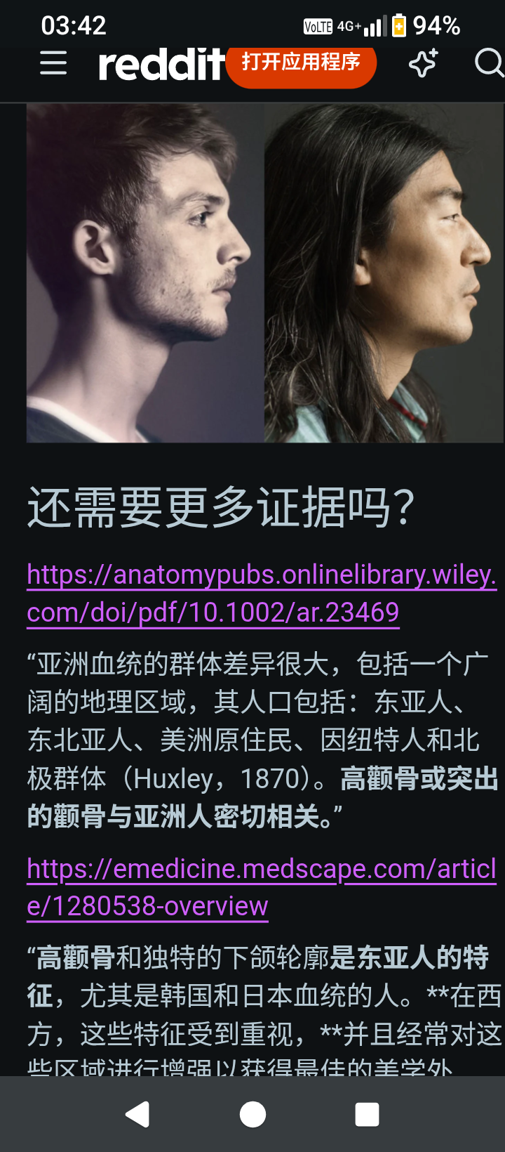 https://media.pincong.rocks/f504a03f55334a7bae9b1faa850dab85.png?width=720&height=1640